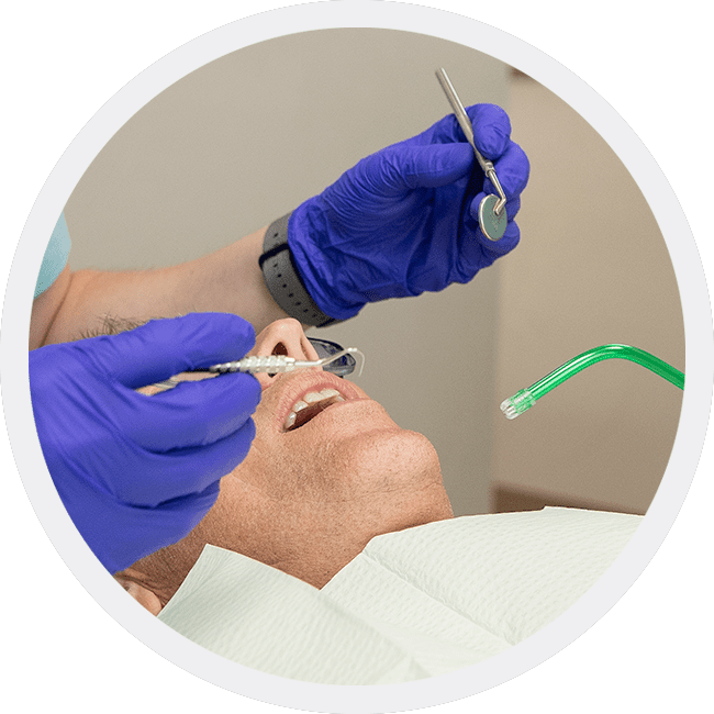 Dental Work Under Sedation | Spring Creek